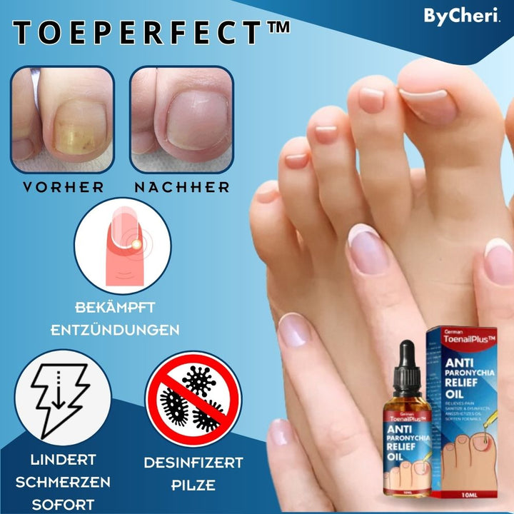 ToePerfect™ - Heilt Zehen- und Handnägel | 1+1 GRATIS TEMPORÄR