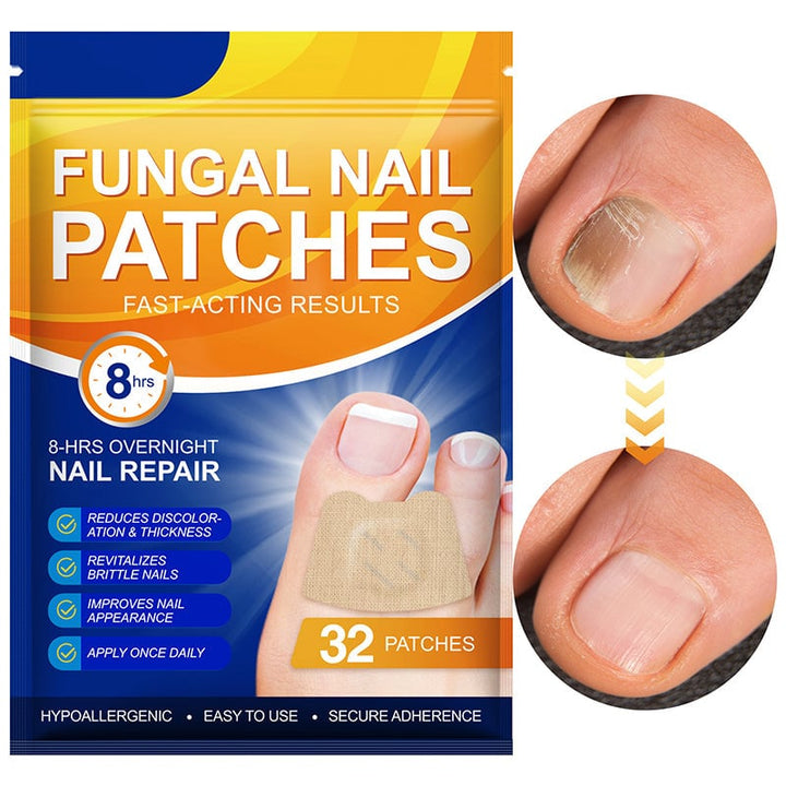 1+1 Gratis | Nailox  | Wirksame Behandlung von Nagelpilz
