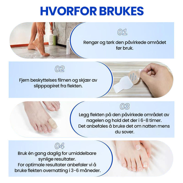 1+1 Gratis | Nailox  | Wirksame Behandlung von Nagelpilz