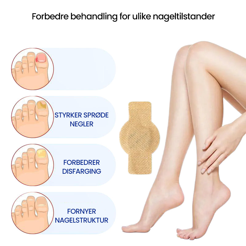1+1 Gratis | Nailox  | Wirksame Behandlung von Nagelpilz