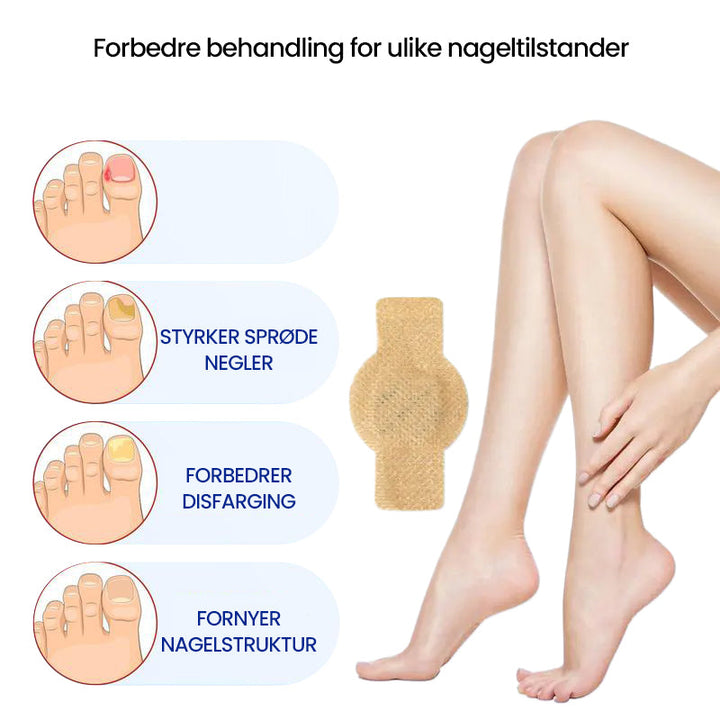1+1 Gratis | Nailox  | Wirksame Behandlung von Nagelpilz