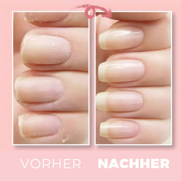 1+1 Gratis | NailWonder™ - Nagelreparatur-Gel