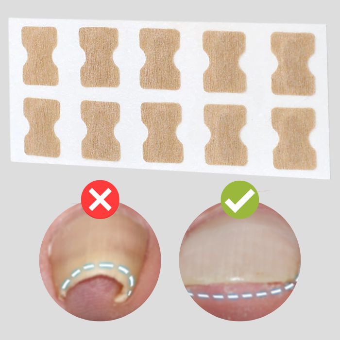 50% Rabatt || NagelWunder | Professionelle Korrekturpflaster für schöne, gesunde Nägel