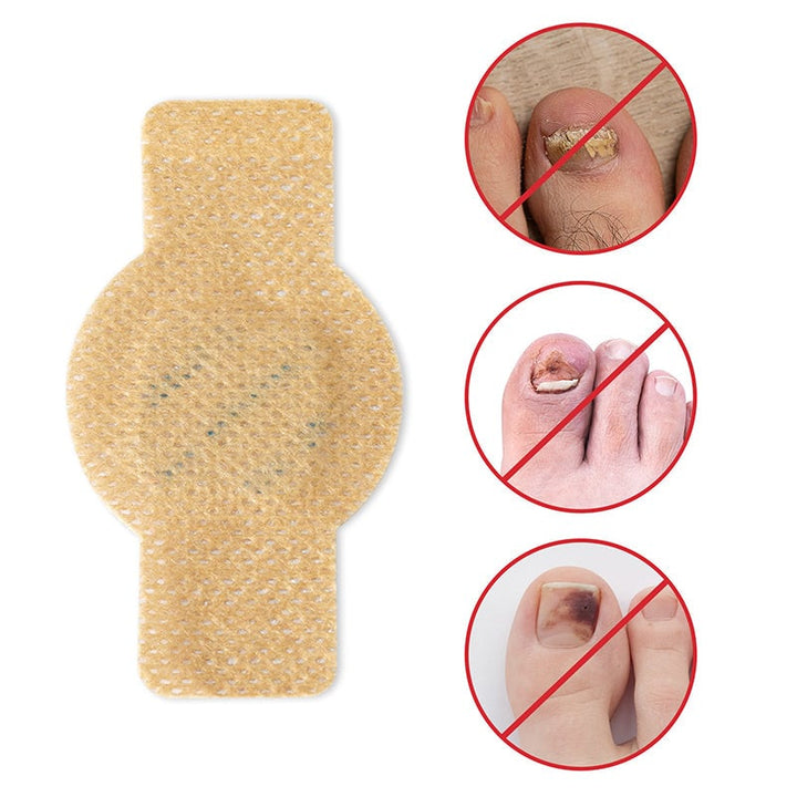 1+1 Gratis | Nailox  | Wirksame Behandlung von Nagelpilz