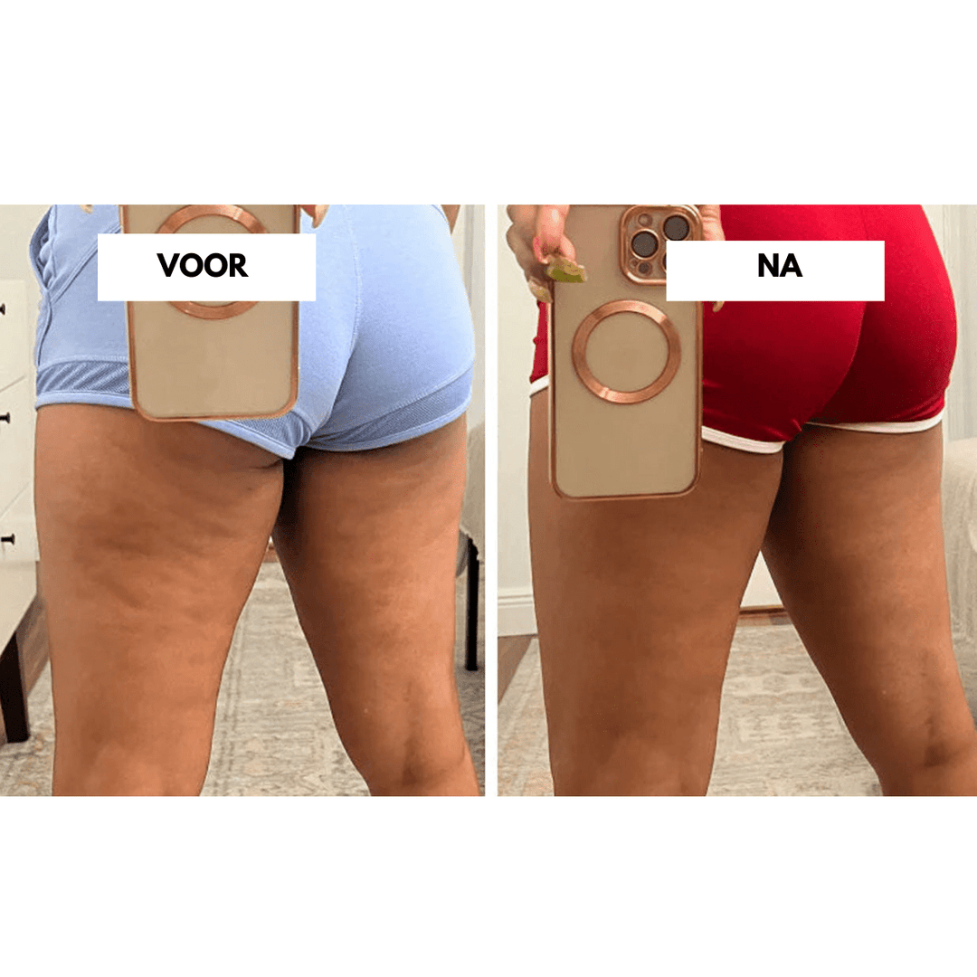 CelluCare Anti-Cellulite Gerät